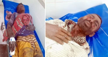 মাটি কাটতে গিয়ে পরিত্যক্ত বোমায় কোদালের আঘাত, বিস্ফোরণে দুই শ্রমিক আহত