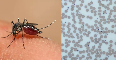 Best Foods to Increase Platelets in Dengue Fever