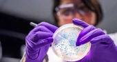The bacteria turning plastic waste into painkillers